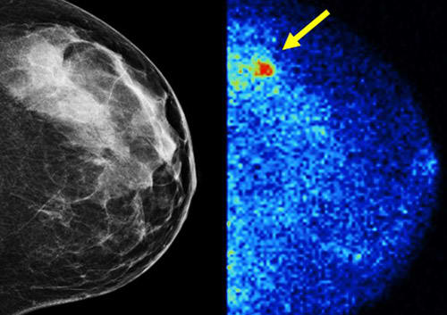 Breast Imaging_Middlesexhealth