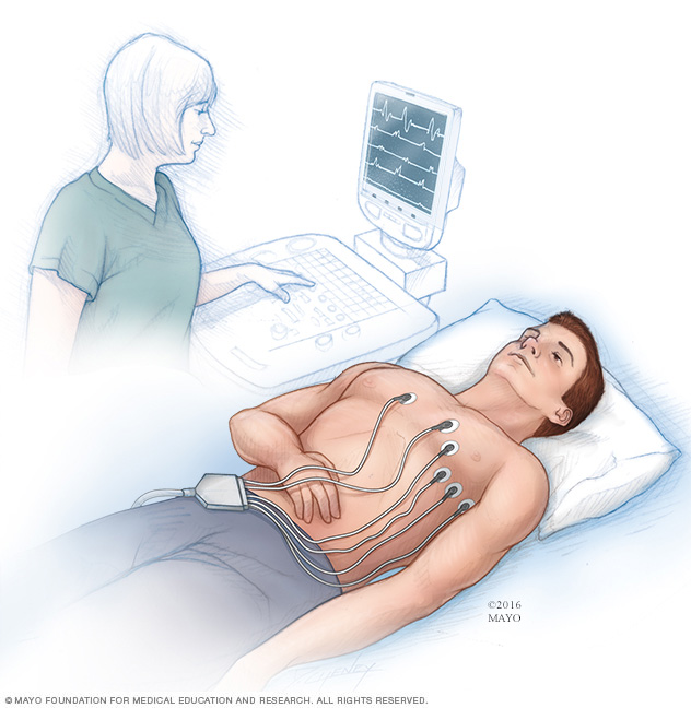 Electrocardiogram (ECG or EKG)