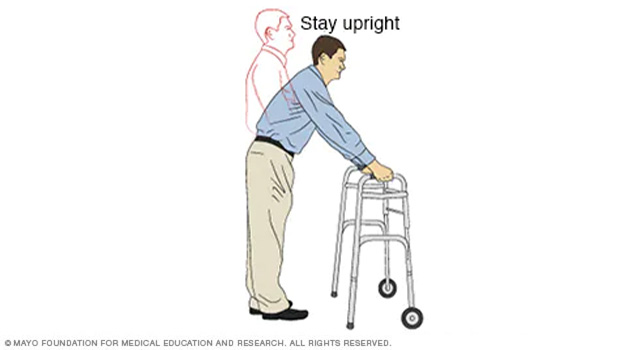 Illustration of a person using a walker incorrectly