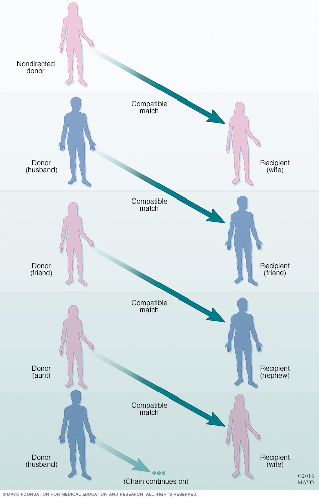 Living-donor organ donation chain