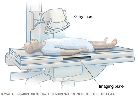 Man having an X-ray exam