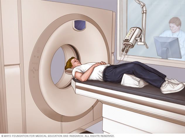 CT scan