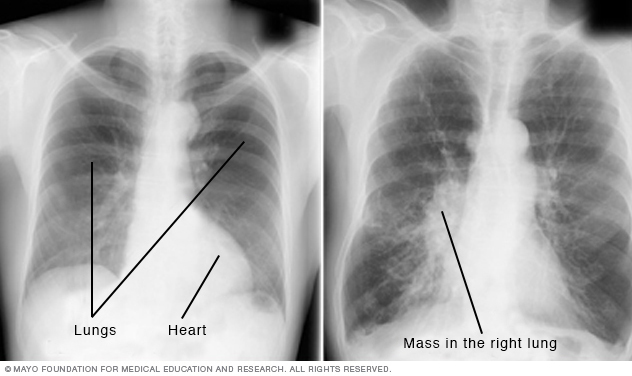 Medical image of chest X-rays