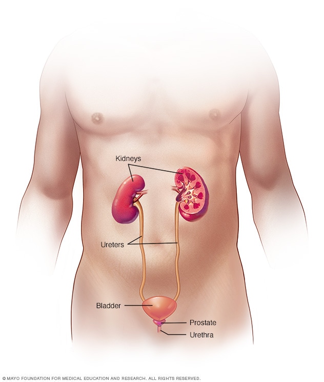 prostatitis és urolithiasis