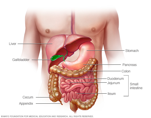 Crohn's disease