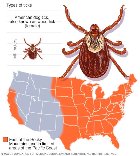 American dog tick