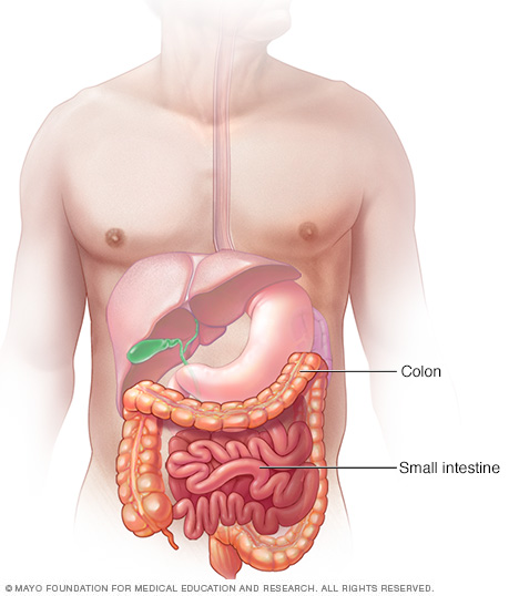 Imagen del colon y del intestino delgado