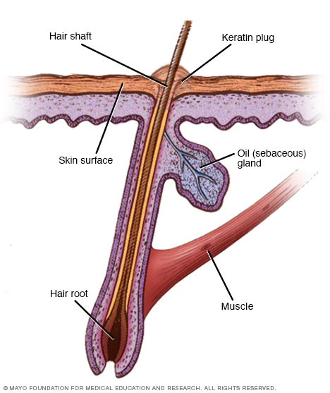 Keratin plug