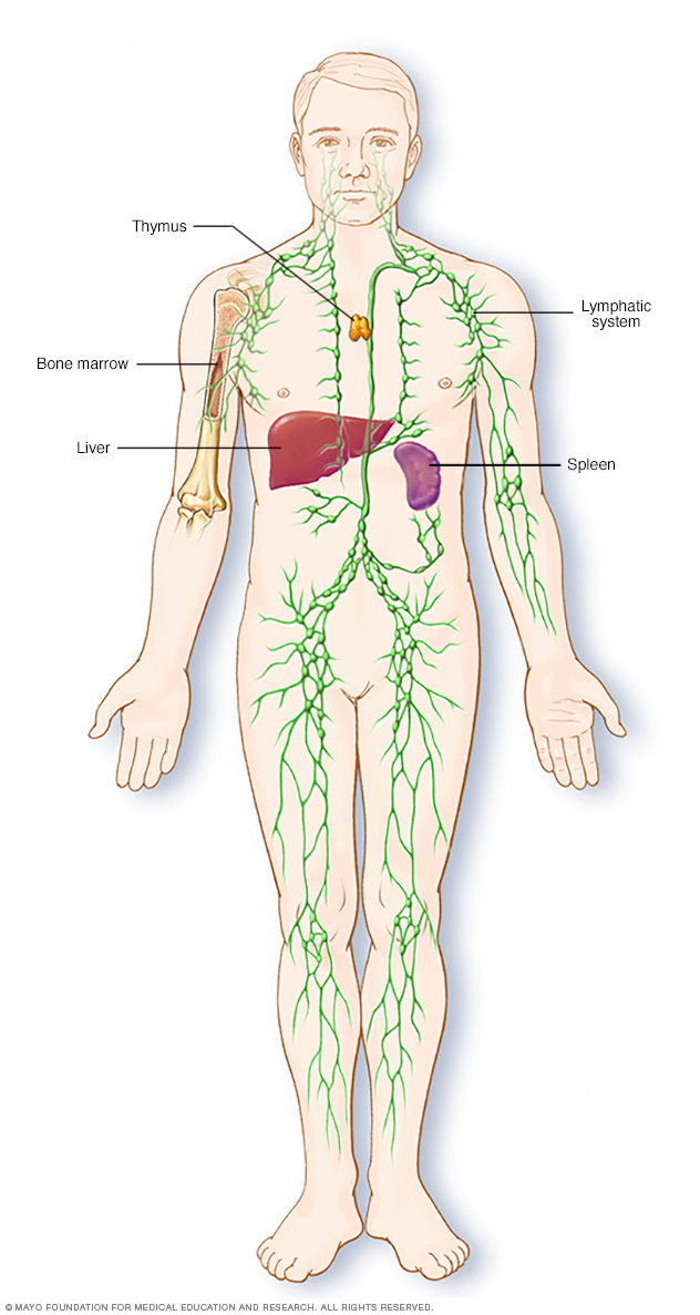 Linfedema // Middlesex Health