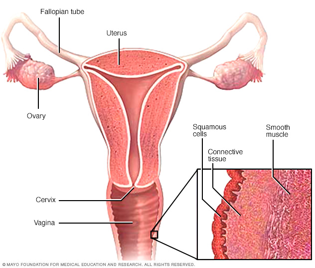 Vaginal Cancer Middlesex Health