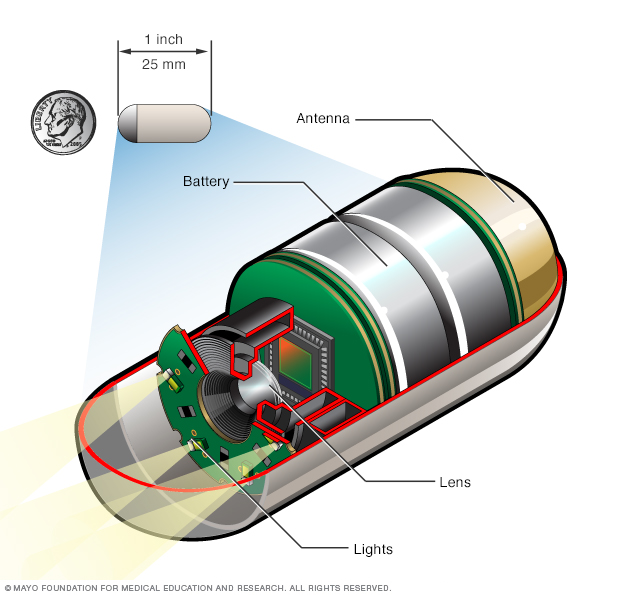 Capsule endoscopy camera