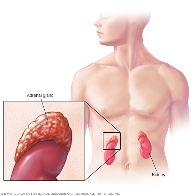 Prednisone And Other Corticosteroids Middlesex Health