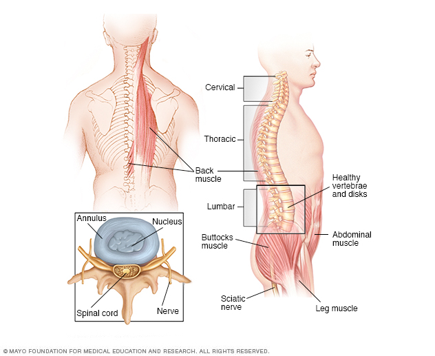 Vertebral tumor // Middlesex Health