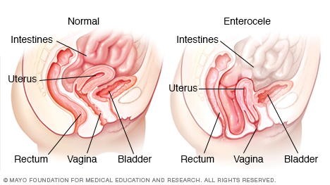 Female urinary system - Mayo Clinic