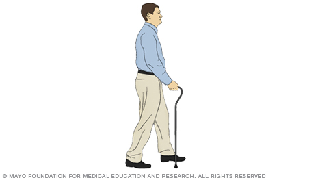 A person taking a step with a cane