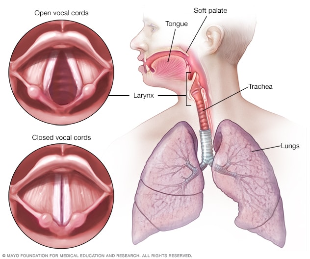 Laryngitis Middlesex Health