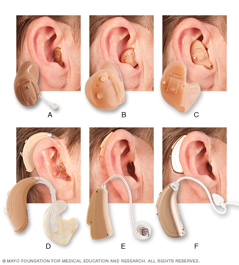 Common hearing aid styles