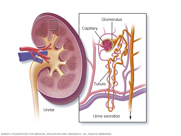 glomerulonephritis images