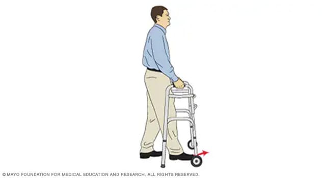 Ilustraci&oacute;n de una persona avanzando con un andador