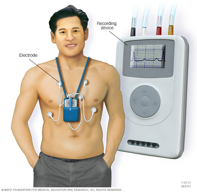 Holter điện tim: Thiết bị theo dõi nhịp tim hiệu quả và an toàn