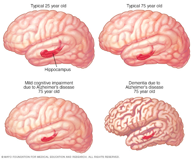 Que controla el lado izquierdo del cerebro