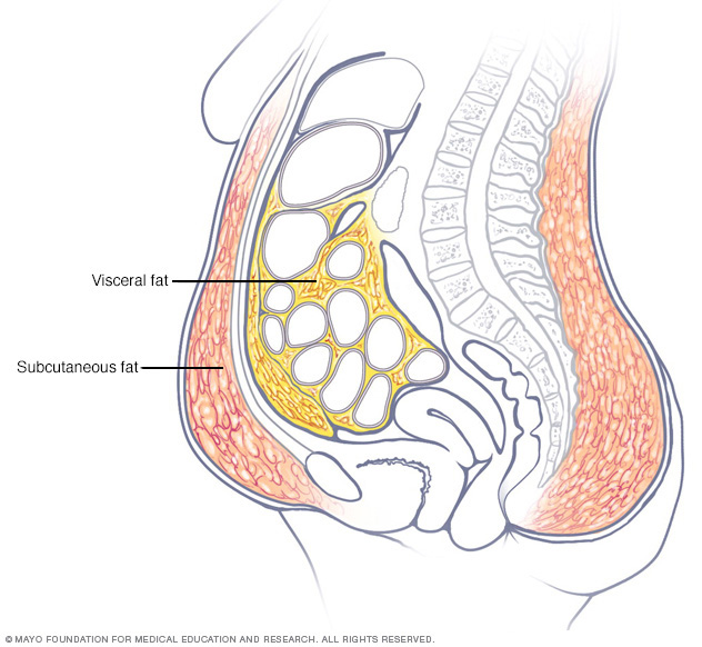 Grasa abdominal en las mujeres: cómo deshacerse de ella y cómo evitar  recuperarla // Middlesex Health