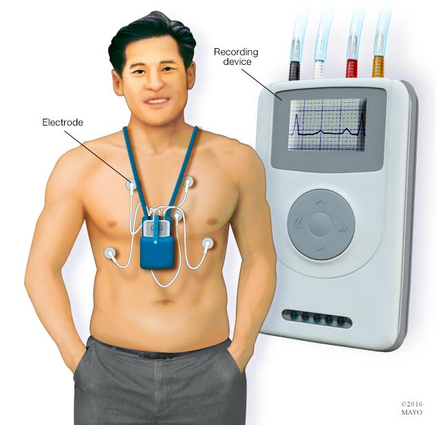 Monitor Holter