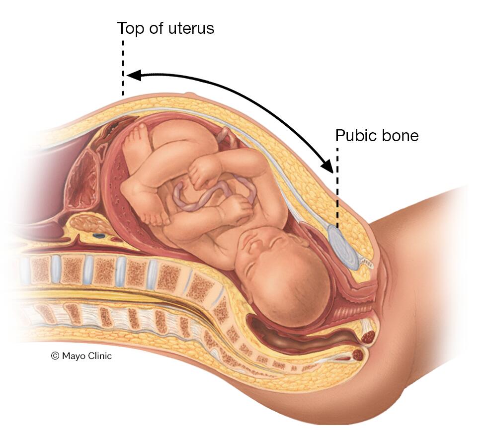 Measurement of fundal height during pregnancy