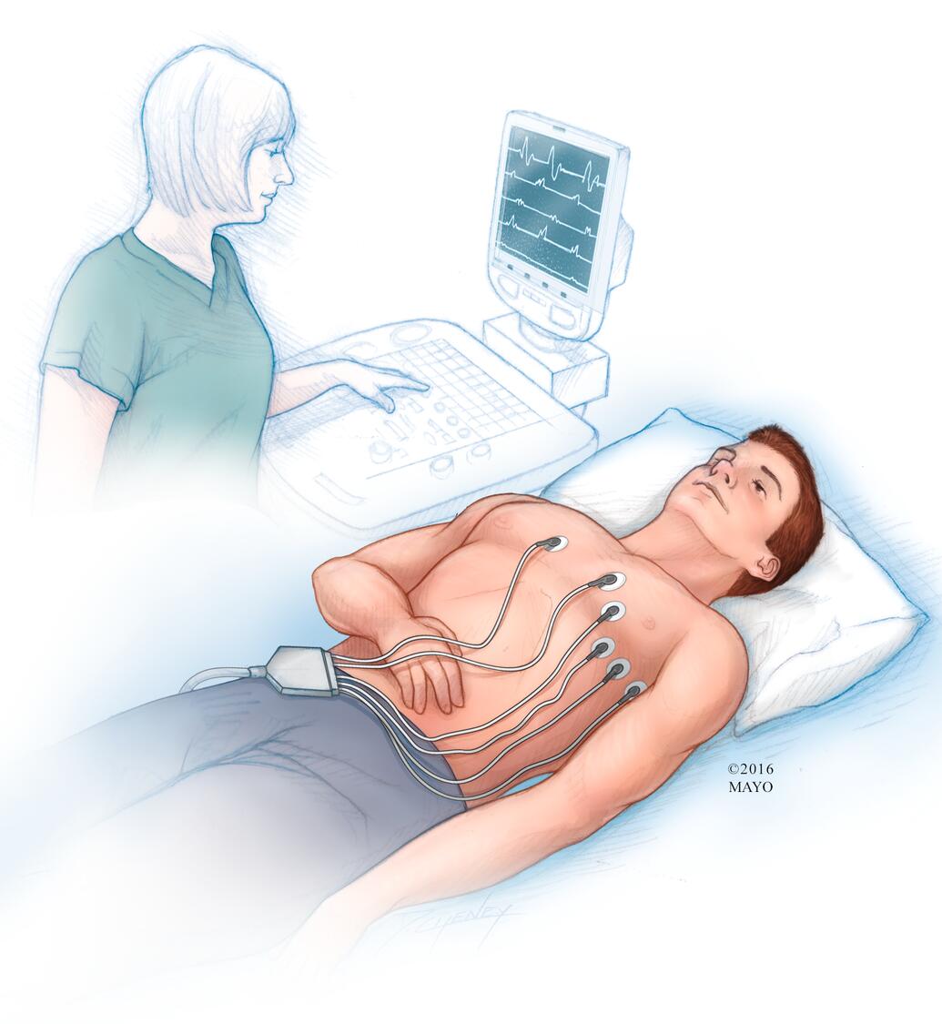 Electrocardiograma