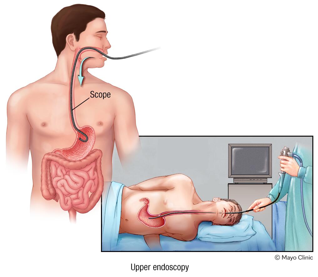 Endoscopy