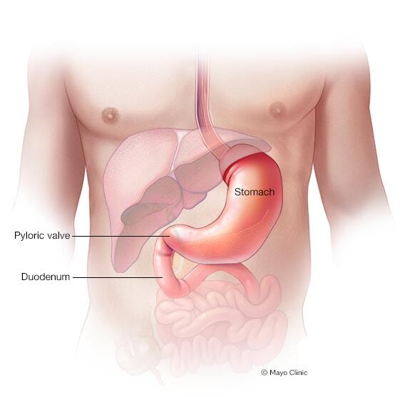 Illustration of stomach, pyloric valve and upper part of small intestine, called the duodenum