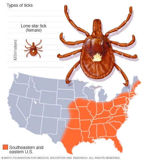 Garrapata estrella solitaria (Amblyomma americanum)