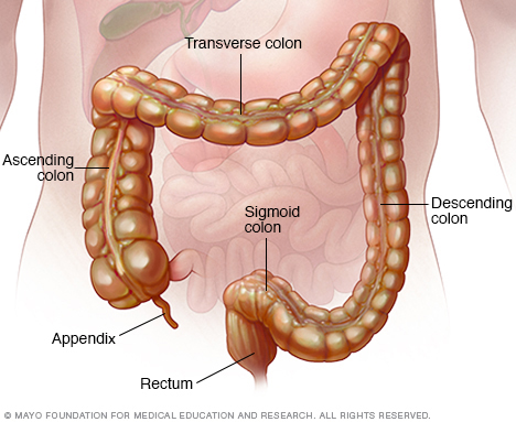 Pseudomembranous Colitis Middlesex Health