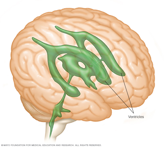 Ventrículos cerebrales 