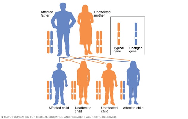 Autosomal dominant inheritance pattern