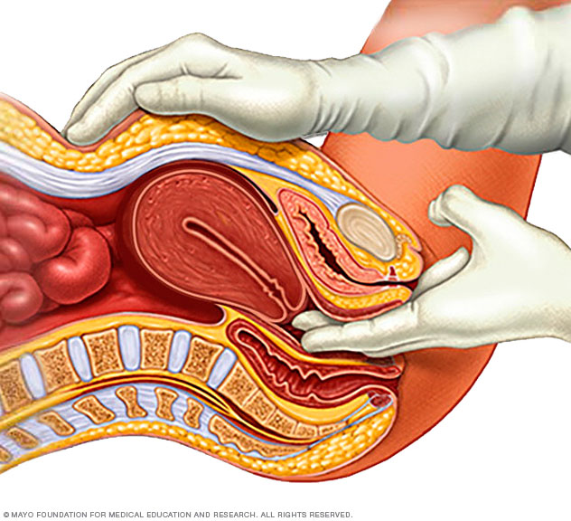 How a pelvic exam is done