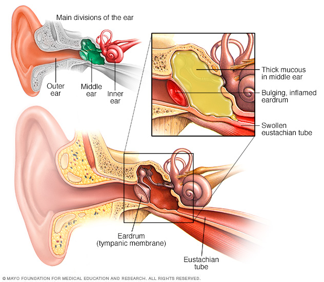 otoscope view ear infection