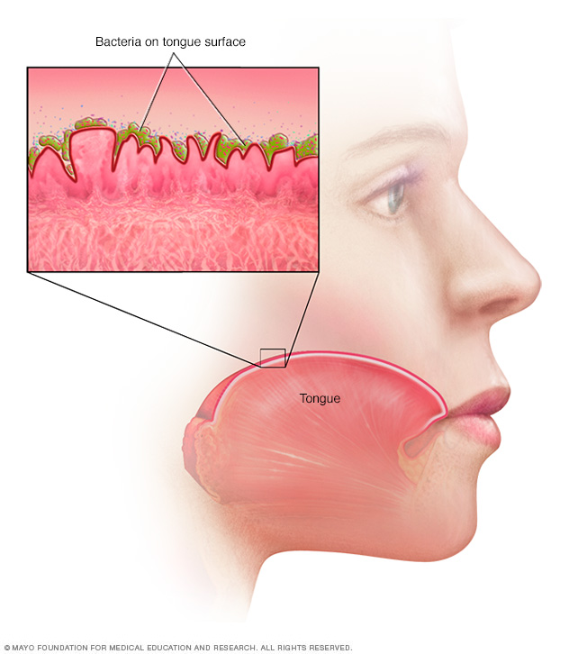 Bacterias en la superficie de la lengua 