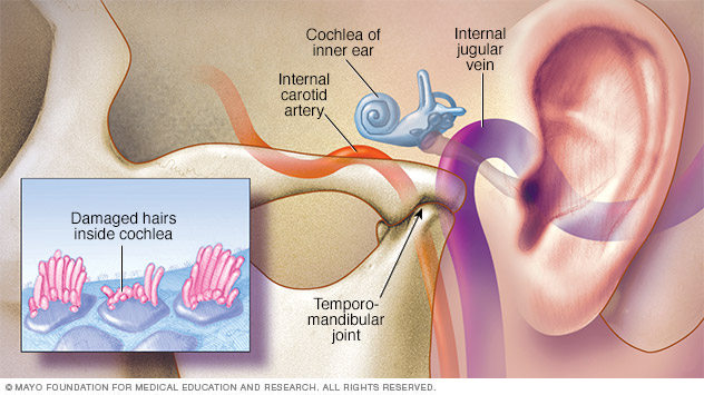 internal carotid artery in ear