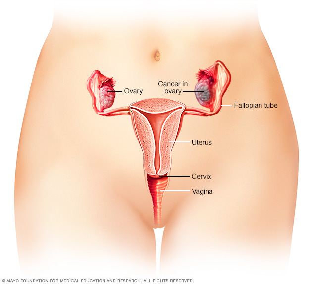 Ovaries: Facts, Function & Disease