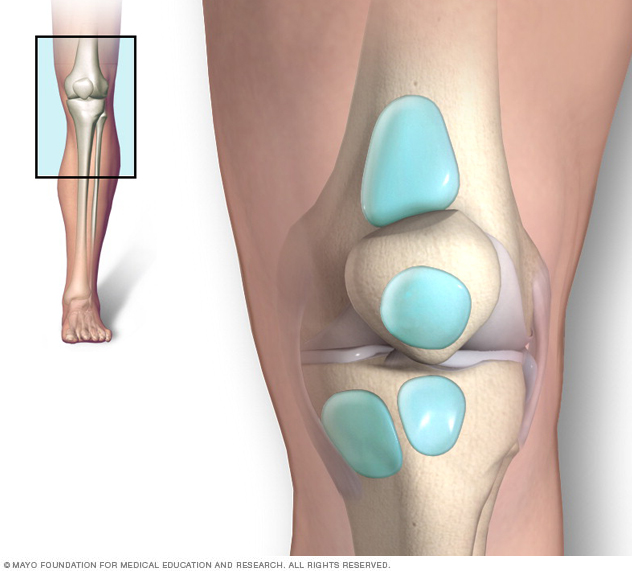 Bursitis de la rodilla // Middlesex Health