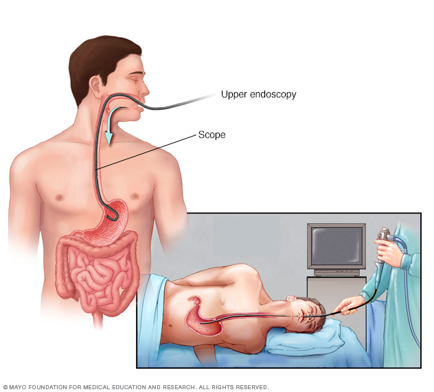 endoskopiassa