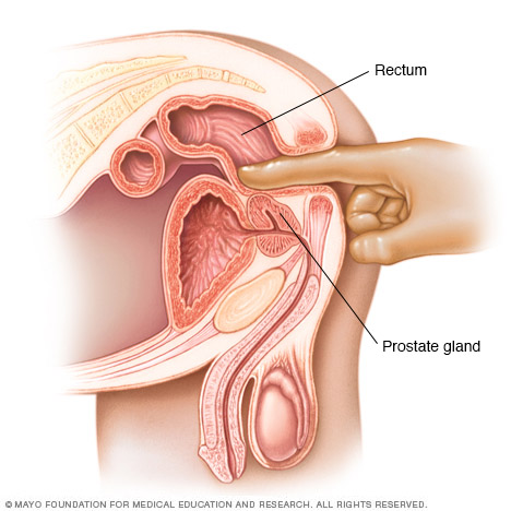 Examen rectal digital 