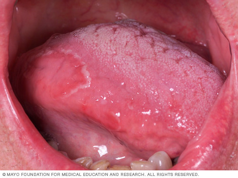 Lengua geográfica 