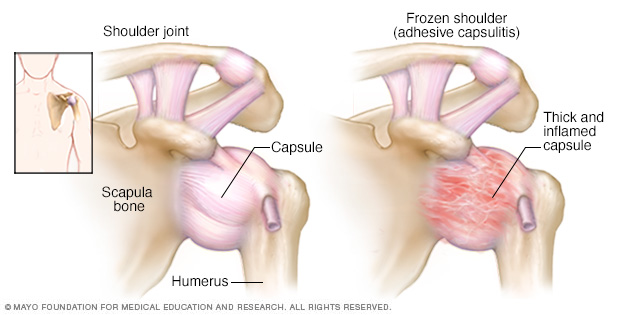 Illustration showing shoulder joint 
