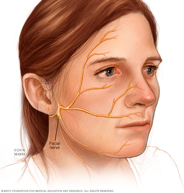 Facial nerve