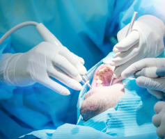 ניתוח הרמת סינוס