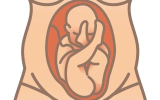 עובר במצב עכוז