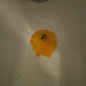 כתם צהוב בכיור, קשור לזיהוי נזילות