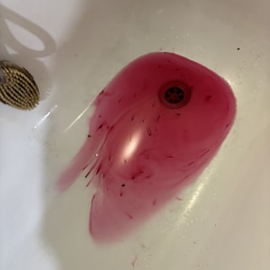 מים אדומים בכיור עם מברשת